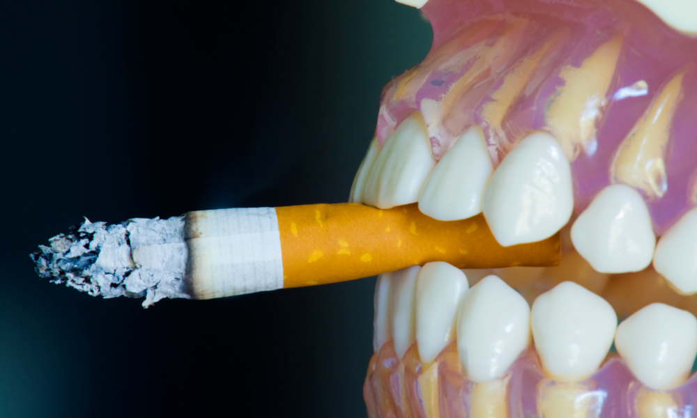 Gum Disease From Smoking